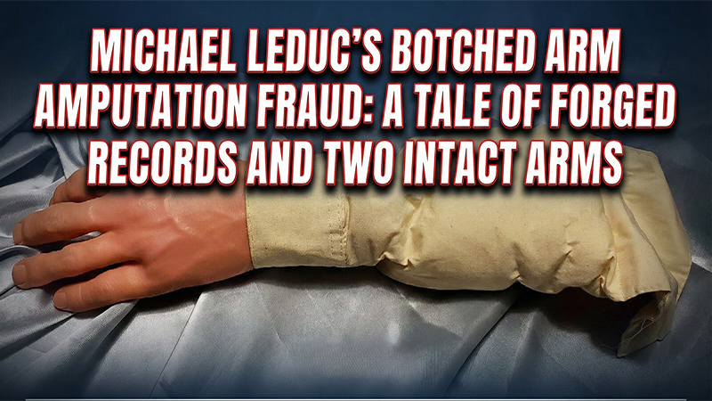 Michael LeDuc’s Botched Arm Amputation Fraud: A Tale of Forged Records and Two Intact Arms
